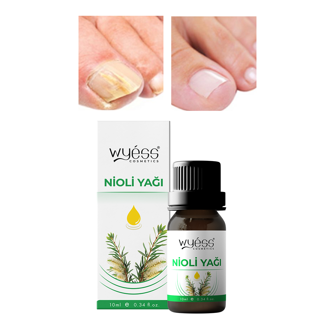 Kadın Hijyen Yağı Doğal Nioli Esansiyel Cilt Bakımı Ferahlatıcı Temizleyici 30ml