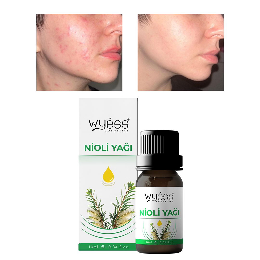 Kadın Hijyen Yağı Doğal Nioli Esansiyel Cilt Bakımı Ferahlatıcı Temizleyici 30ml