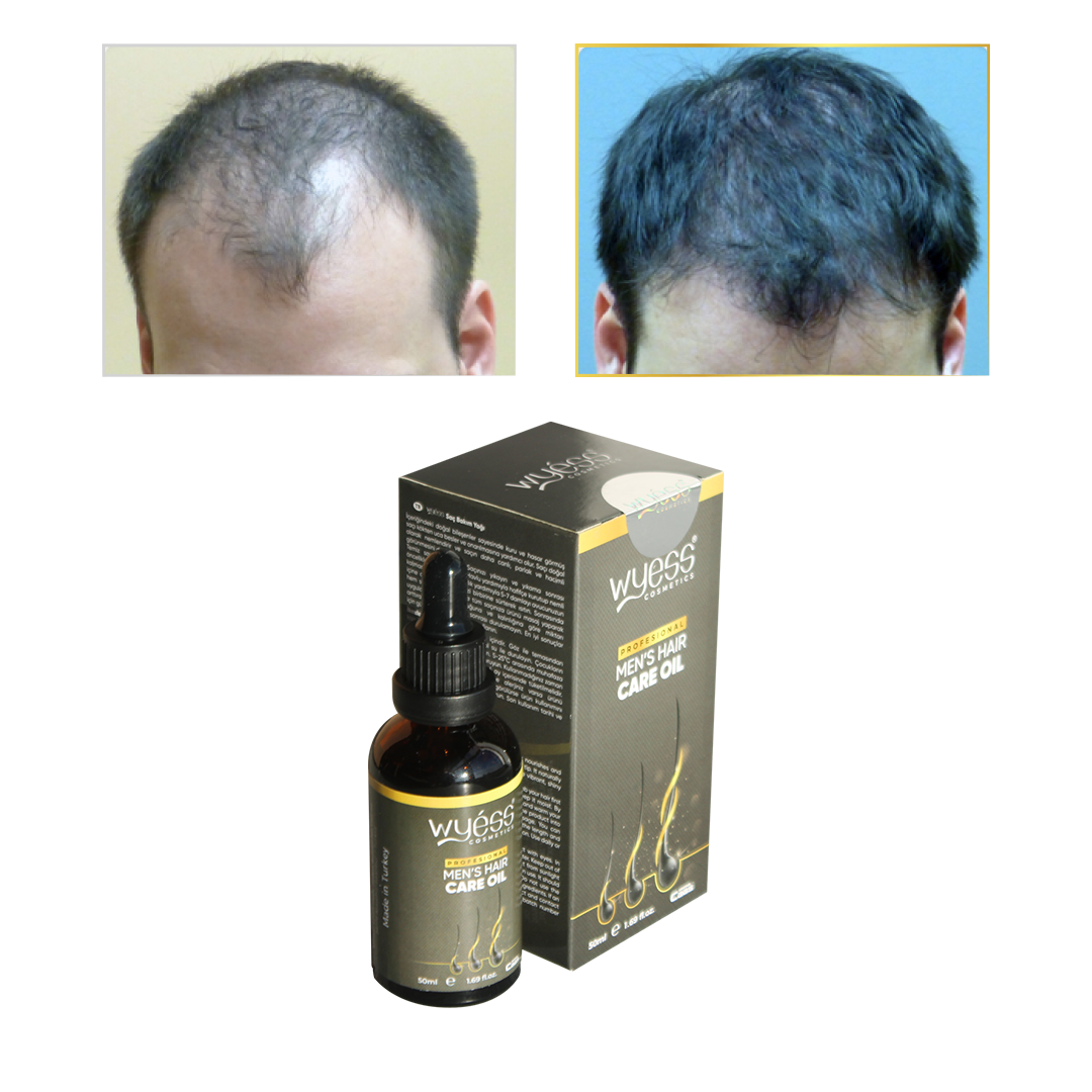 Erkekler için Saç Yağı Argan Büyüme Doğal Parlaklık En İyi Saç Bakım Tedavisi Wyess 100ml