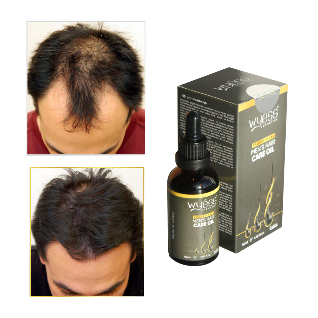 Erkekler için Saç Yağı Argan Büyüme Doğal Parlaklık En İyi Saç Bakım Tedavisi Wyess 100ml