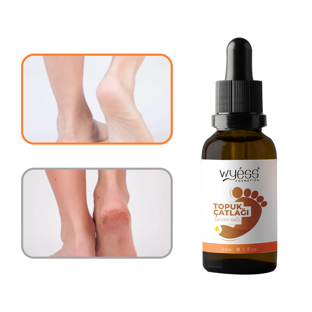 Çatlak Topuklar için Yağ
Kuru Cilt Onarımı
Yumuşak Pürüzsüz Doğal Bakım
50ml