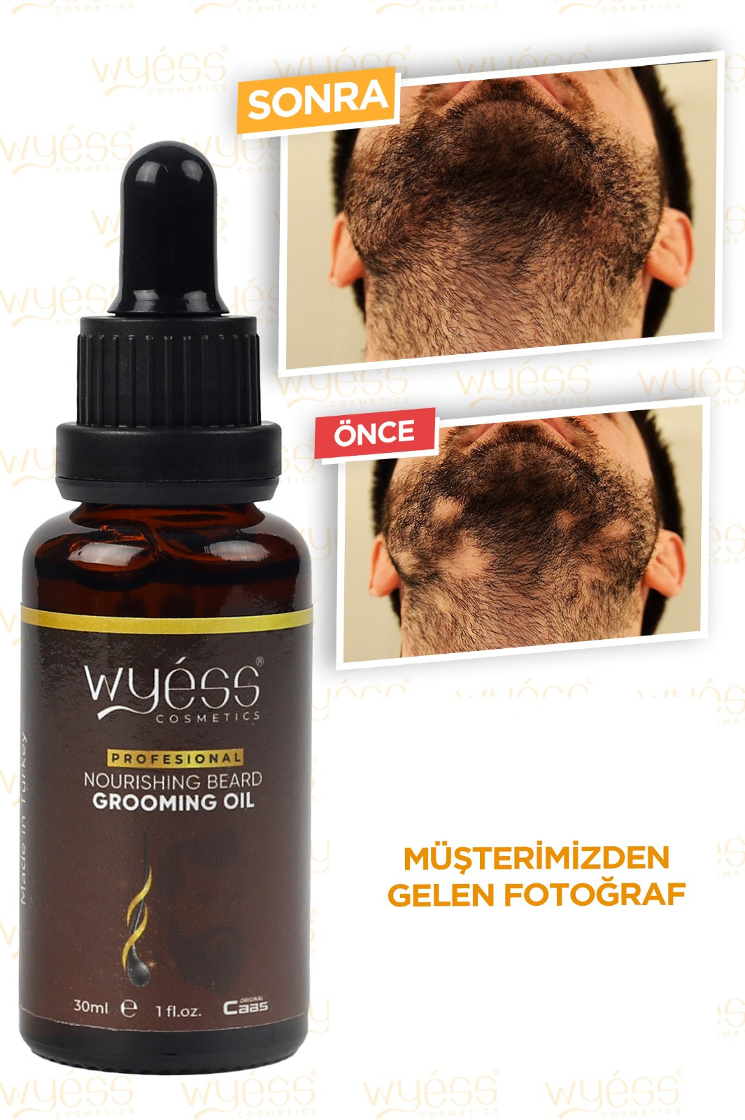 Wyess Beard Oil for Men Beard Growth Oil Kit Natural Beard Conditioner Moisturizer 30ml