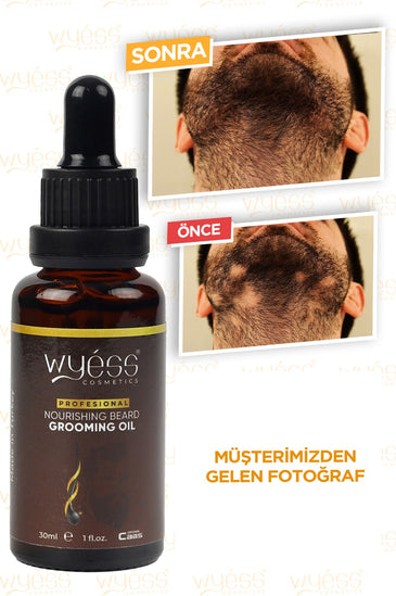 Wyess Beard Oil for Men Beard Growth Oil Kit Natural Beard Conditioner Moisturizer 30ml
